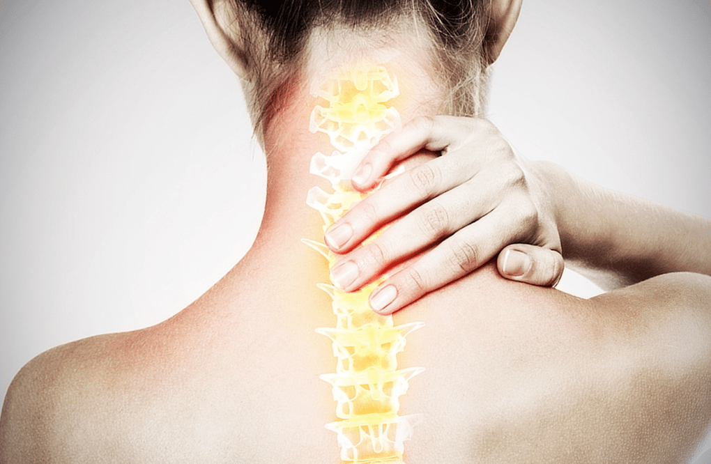 spinálna osteochondróza